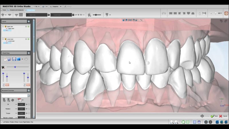 Фото ПО AGE Solutions S.r.l. Maestro 3D Ortho Studio 2