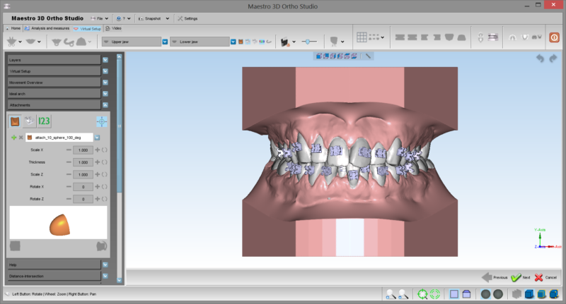 Фото ПО AGE Solutions S.r.l. Maestro 3D Ortho Studio 3