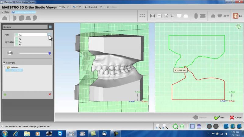 Фото ПО AGE Solutions S.r.l. Maestro 3D Ortho Studio 5