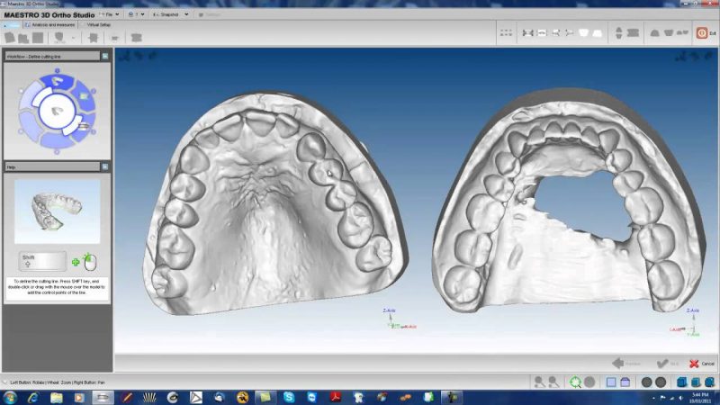 Фото ПО AGE Solutions S.r.l. Maestro 3D Ortho Studio 6