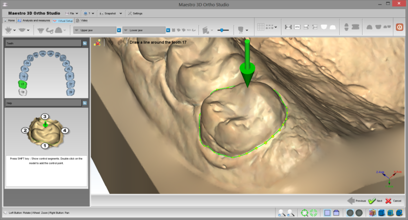 Фото ПО AGE Solutions S.r.l. Maestro 3D Ortho Studio 7