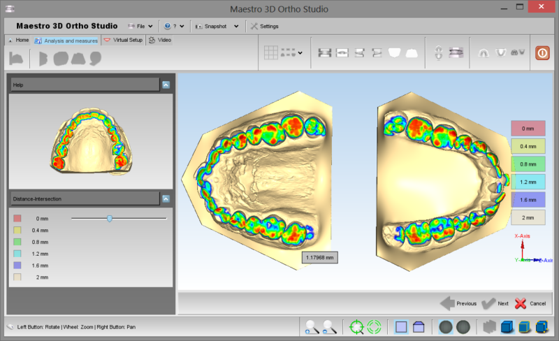 Фото ПО AGE Solutions S.r.l. Maestro 3D Ortho Studio 9