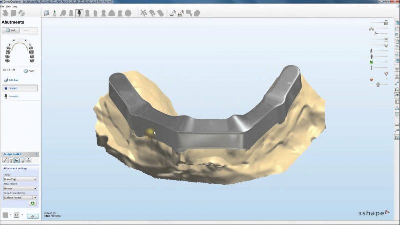 Фото ПО для стоматологии Abutment Designer and Implant Bar and Bridge Design_1