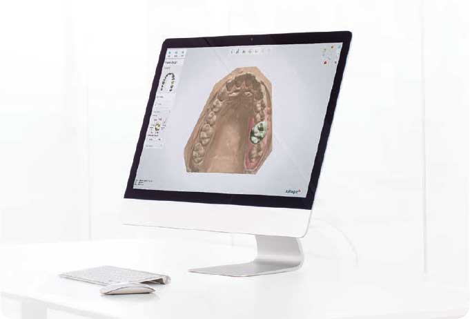 Фото ПО для стоматологии Dental System™ Standard второе рабочее место_1