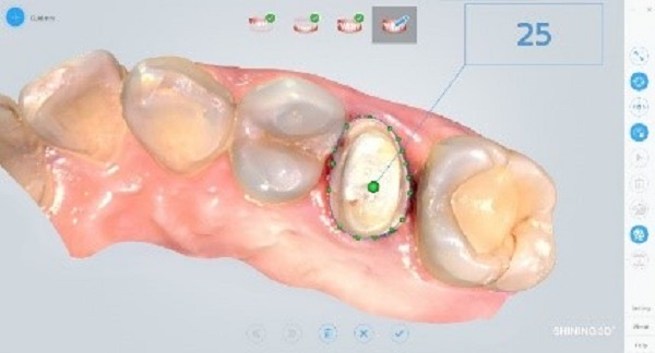 Фото интраорального сканера Shining 3D Aoralscan 19
